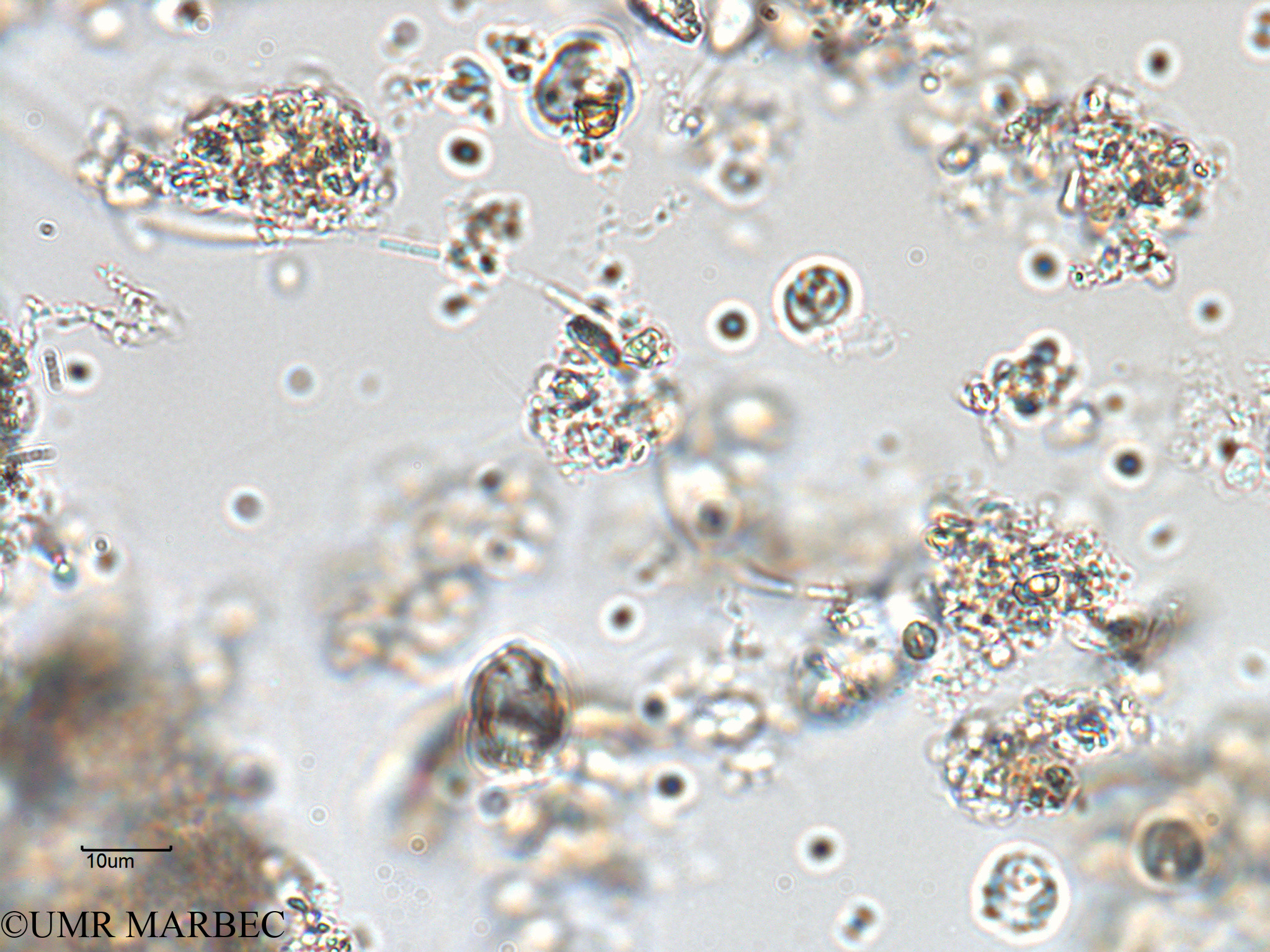 phyto/Bizerte/bizerte_lagoon/RISCO February 2015/Planktolyngbya sp1 (ancien Lagune_T5-C3-Cyano spp).tif(copy).jpg